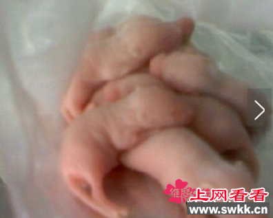 女孩怀孕老鼠