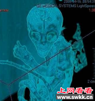 外星人婴儿模拟照片