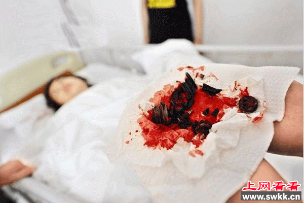 气压升降椅爆炸