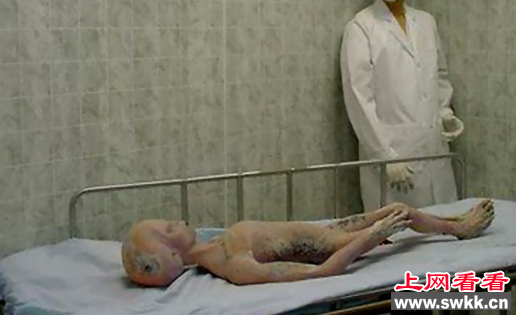 解剖外星人尸体