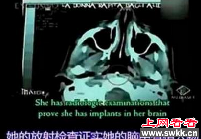 外星人婴儿