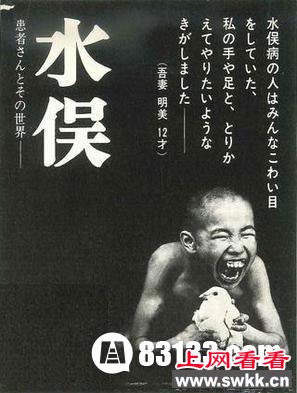 日本水俣病事件