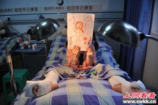 双胞胎女孩脚筋被砍