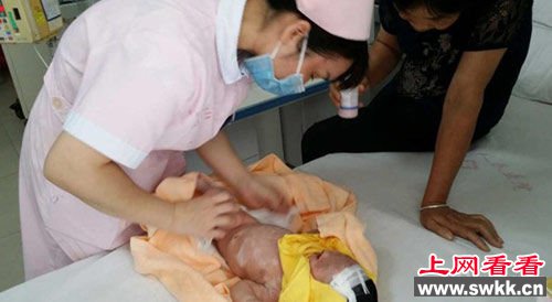 兔唇男婴被弃荒野