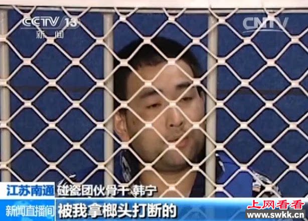 为碰瓷敲断锁骨