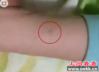 多名儿童反映被老师扎手指
