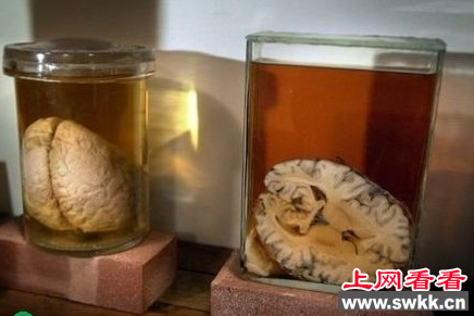 二十年福尔马林浸泡标本睁开眼 