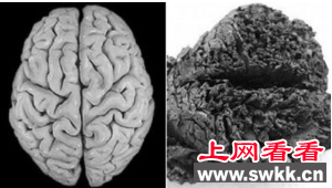 保存了近4000年的人脑