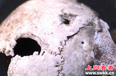 希特勒头骨