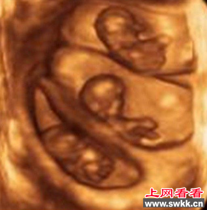 印度一妇女一次产下11胞胎