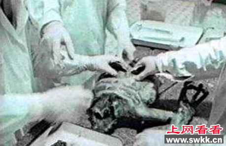 外星人解剖
