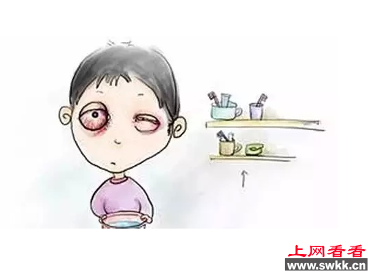 红眼病