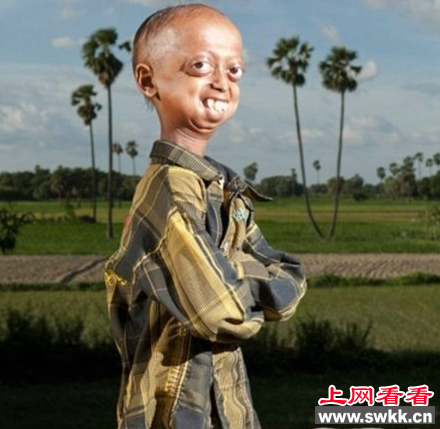 早衰
