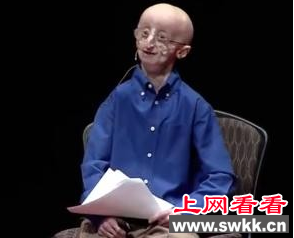 早衰少年