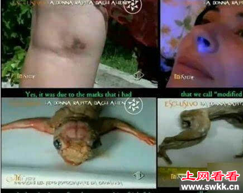 女子产下外星人