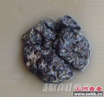 出土完整的人脑组织